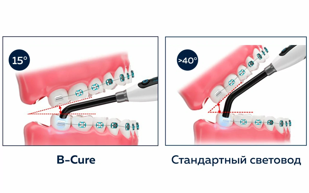 B-Cureэргономика.jpg.jpeg