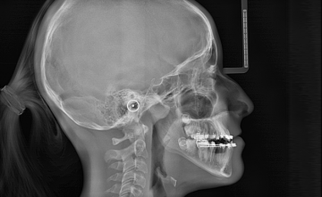 thumb_3307_default_product_property.png